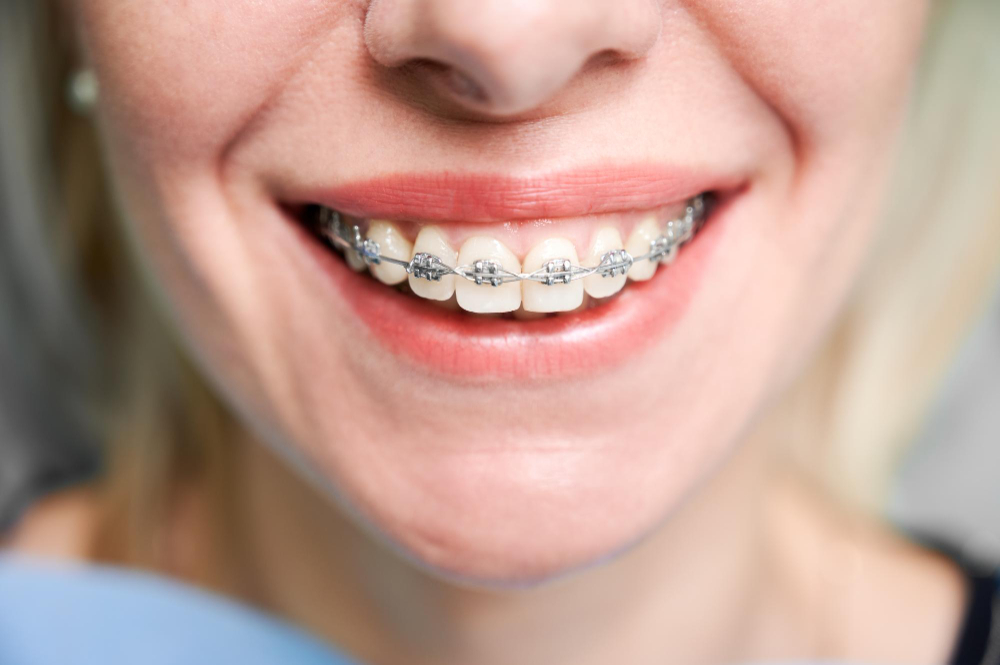 orthodontic services Saginaw, MI